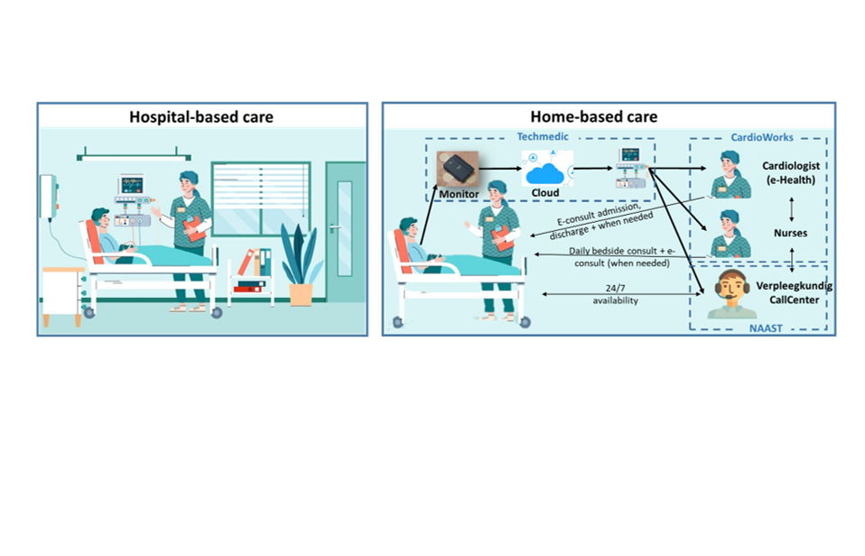Hospital at home homebased monitoring for early discharge following