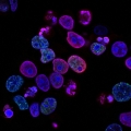 Afweercel Wordt Tumorcel Door Moleculaire Switch naar Hogere Vetopname - Eiwit CD37 Speelt Belangrijke Rol bij Ontstaan en Prognose van B-cellymfoom