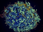 Vooraankondiging Nieuwe KIC-Call: ‘Hiv-Genezing voor Iedereen’