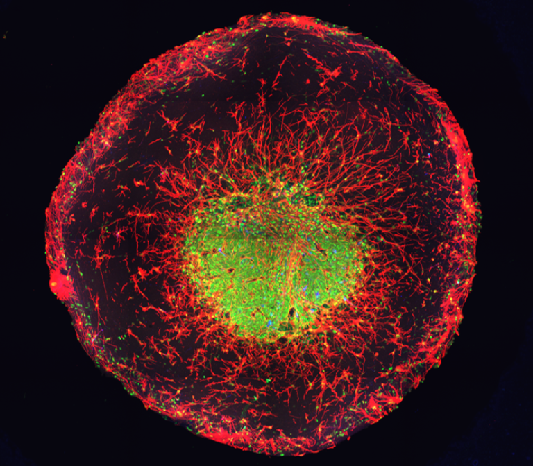 Studying schizophrenia with mini-brains