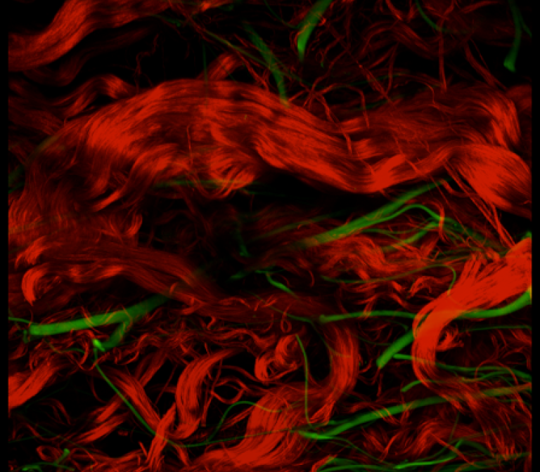 The stretching of skin studied with 3D microscopy.