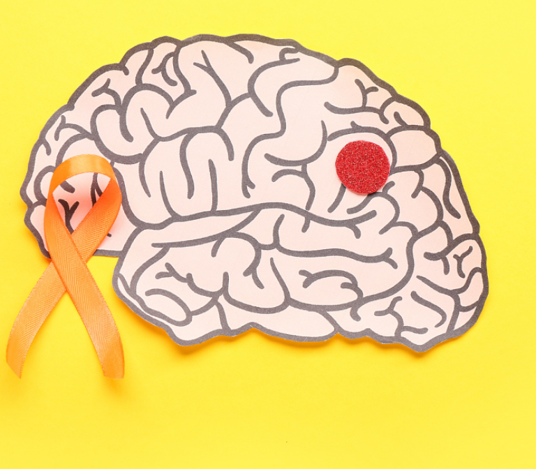 Understand and exploit endogenous protection mechanisms to combat neuro-inflammation