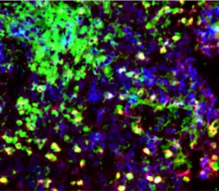 Preventing tissue damage by inhibiting neutrophils in autoimmunity