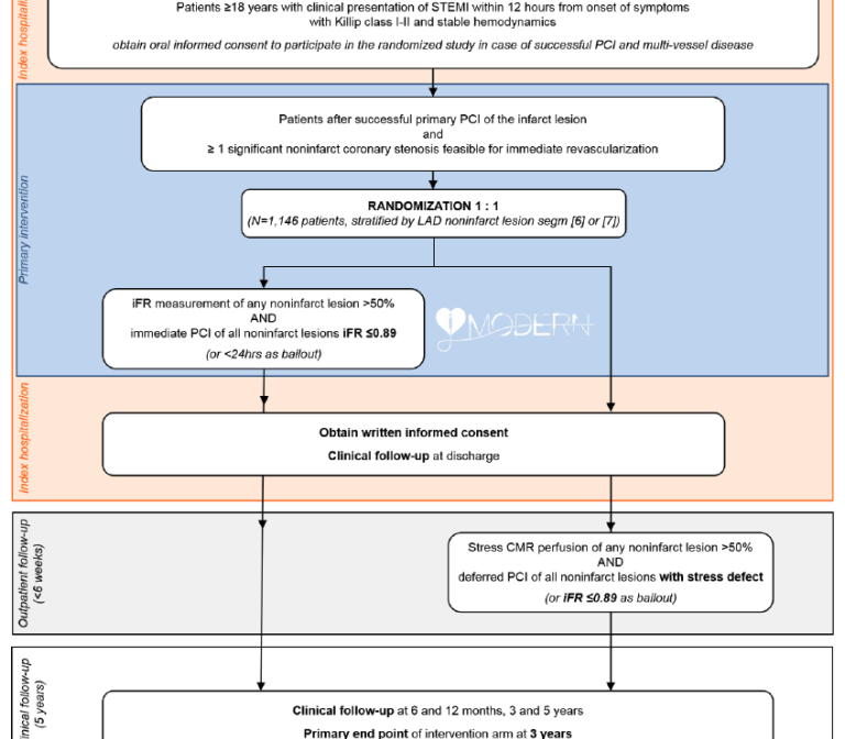 Immediate pressure-guided multivessel revascularisation after an acute myocardial infarction