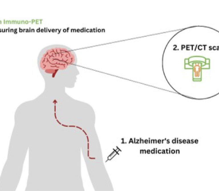 Measuring brain delivery of novel medication for Alzheimer’s Disease