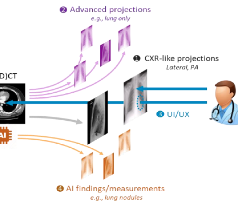 Improving upon conventional chest radiography diagnostics