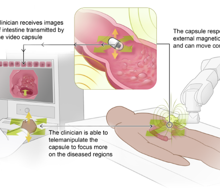Magnetic Navigation and Artificial Intelligence for Gastrointestinal Diagnostics