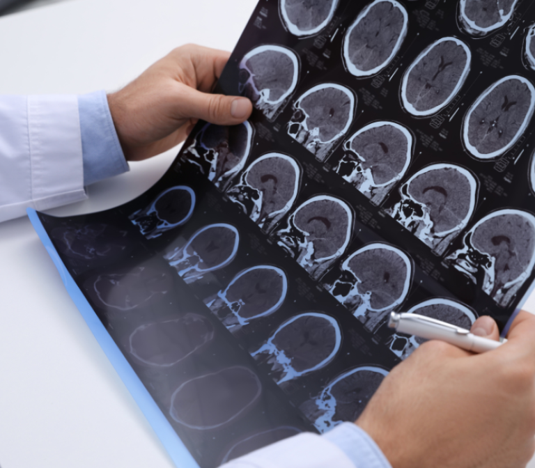 Radiological workflow for diagnostic and treatment decisions in multiple sclerosis