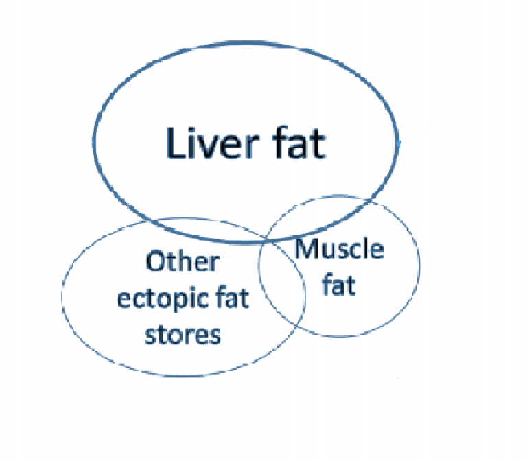 Liver fat accumulation and cardiovascular risk: new ways to prevention and treatment