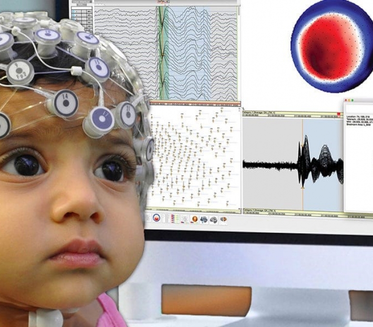 Targeting epilepsy with electrodes on the head