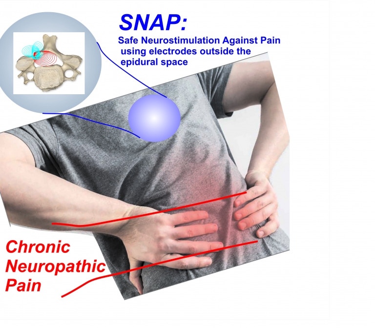 Safe Neurostimulation Against Pain 