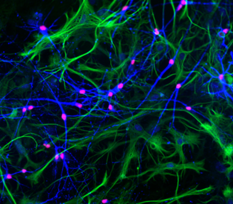 Measuring electrical activity of cultured human neurons