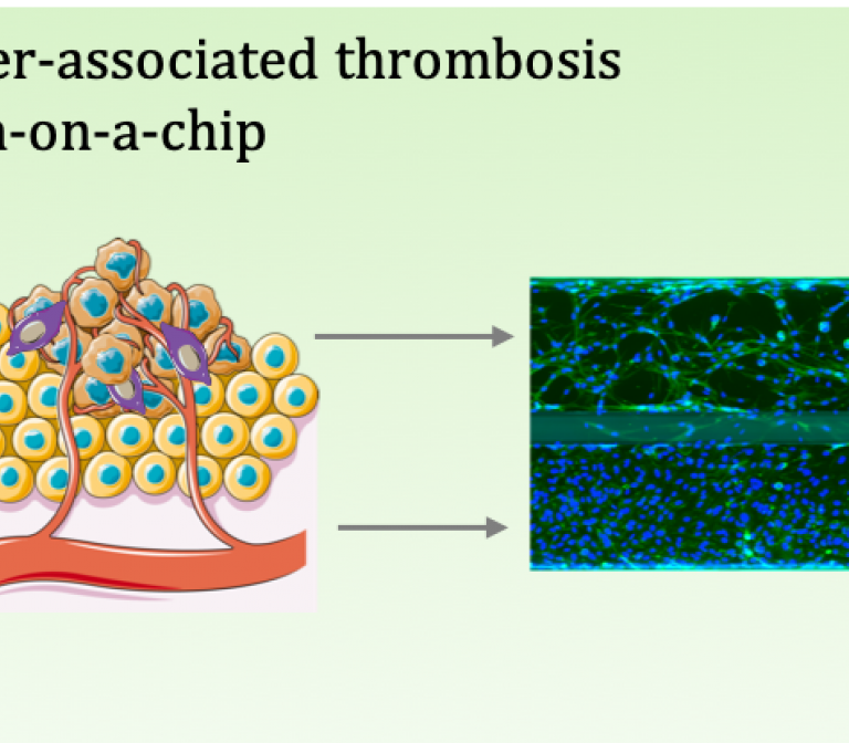 Developing animal-free methods to study thrombosis in cancer patients. 