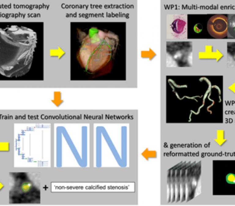 Deep learning for plaque segmentation in Computed Tomography Images