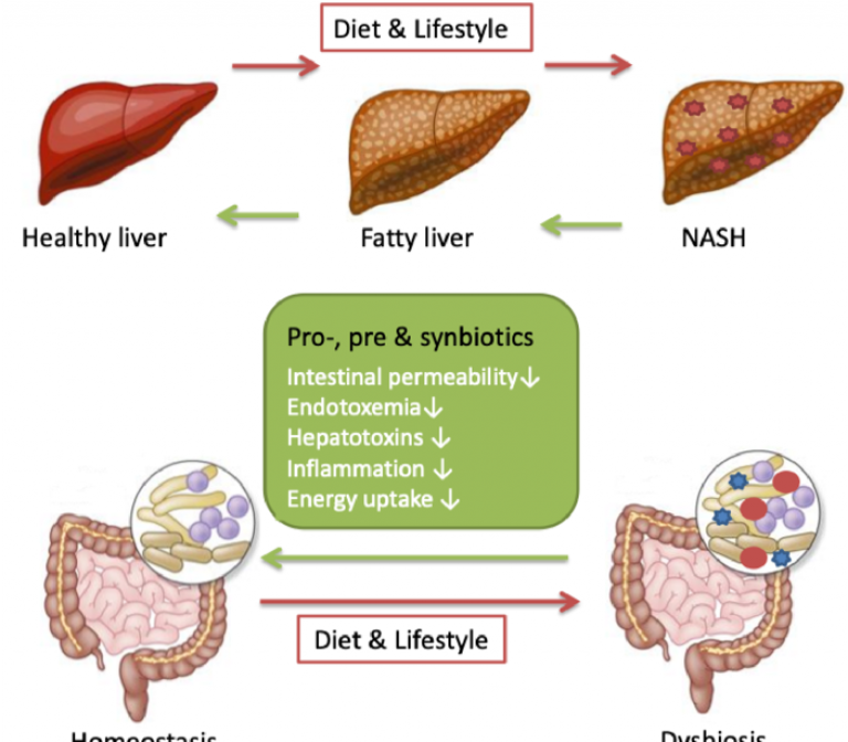 Butyric acid-forming intestinal bacteria: a new treatment against non-alcoholic fatty liver