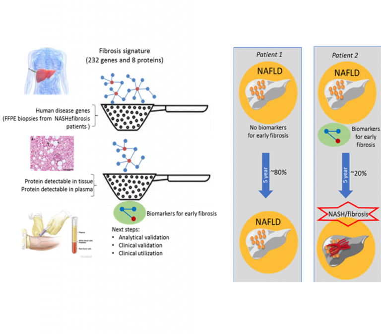 Biomarkers for early detection of NASH-induced fibrosis in humans